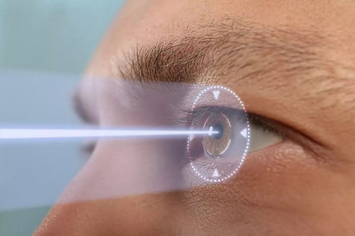 Cool Laser Under Eye Treatment Guide: Explore the Basics, Benefits, and Recovery