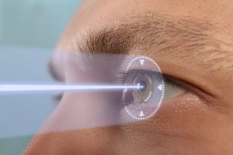 Cool Laser Under Eye Treatment Guide: Explore the Basics, Benefits, and Recovery